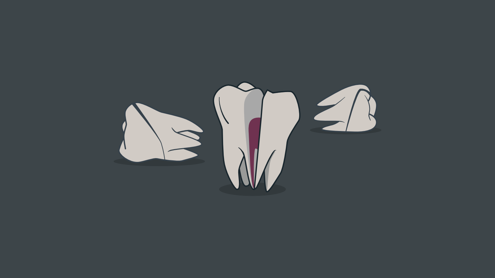 What losing three teeth taught me about management