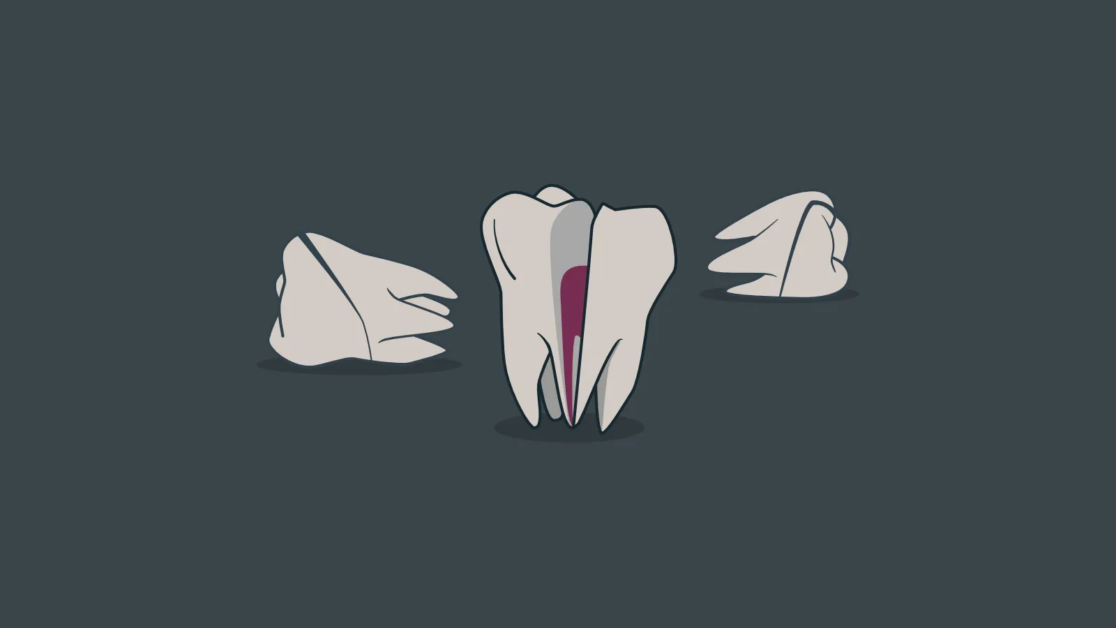 What losing three teeth taught me about management